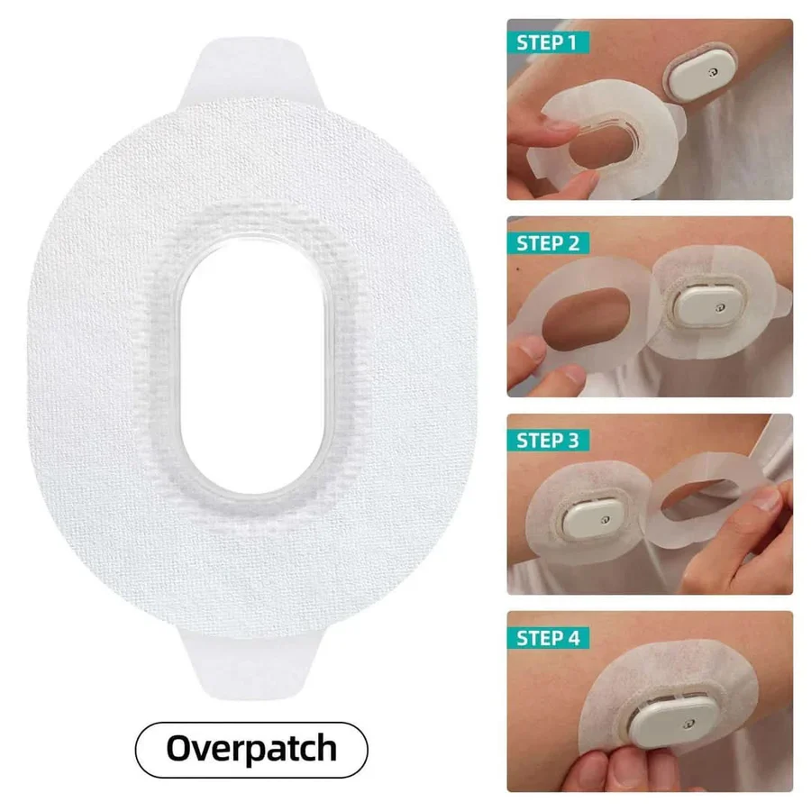 Ghid overpatch